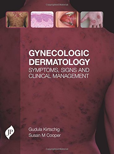 Gynecologic-Dermatology-Symptoms-Signs-and-Clinical-Management-1st-Edition-SZqSG