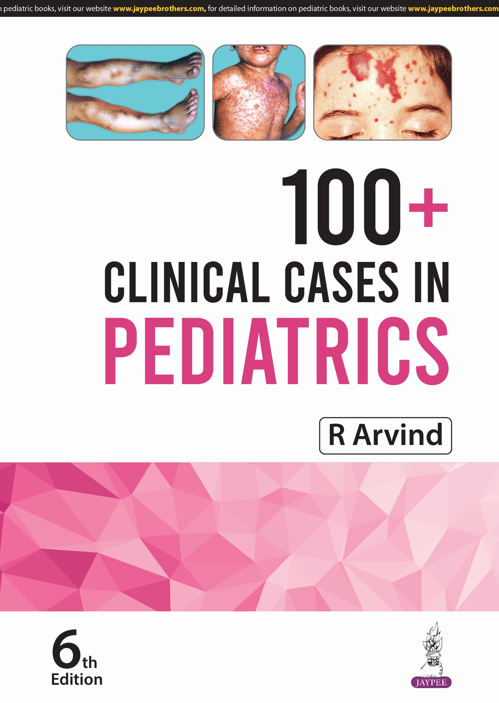 100-Clinical-Cases-In-Pediatrics-6th-Ed-By-R-Arvind-Ca6bp